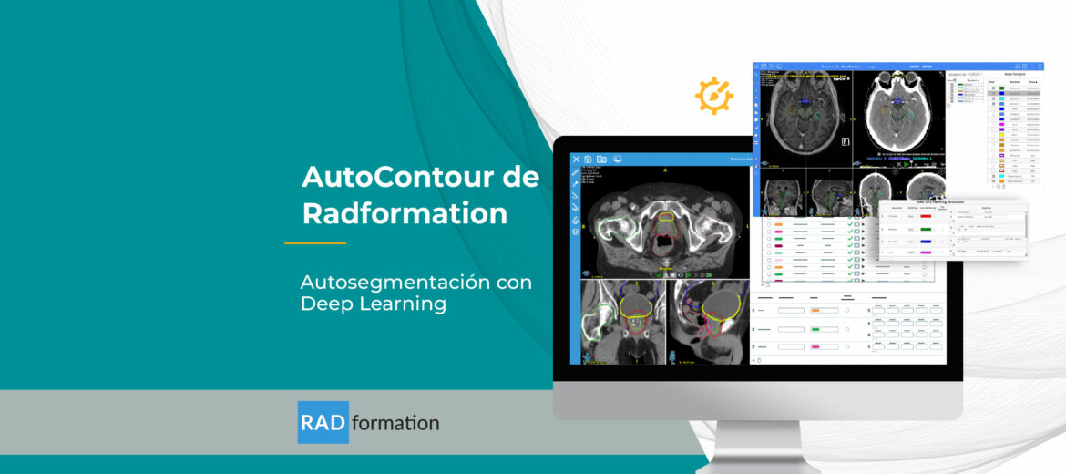 autocontour-deep-learning-para-radioterapia-radformation