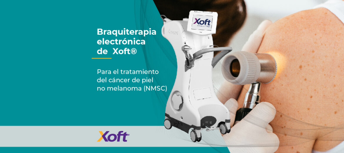 braquiterapia electrónica sistema Xoft cáncer no melanoma