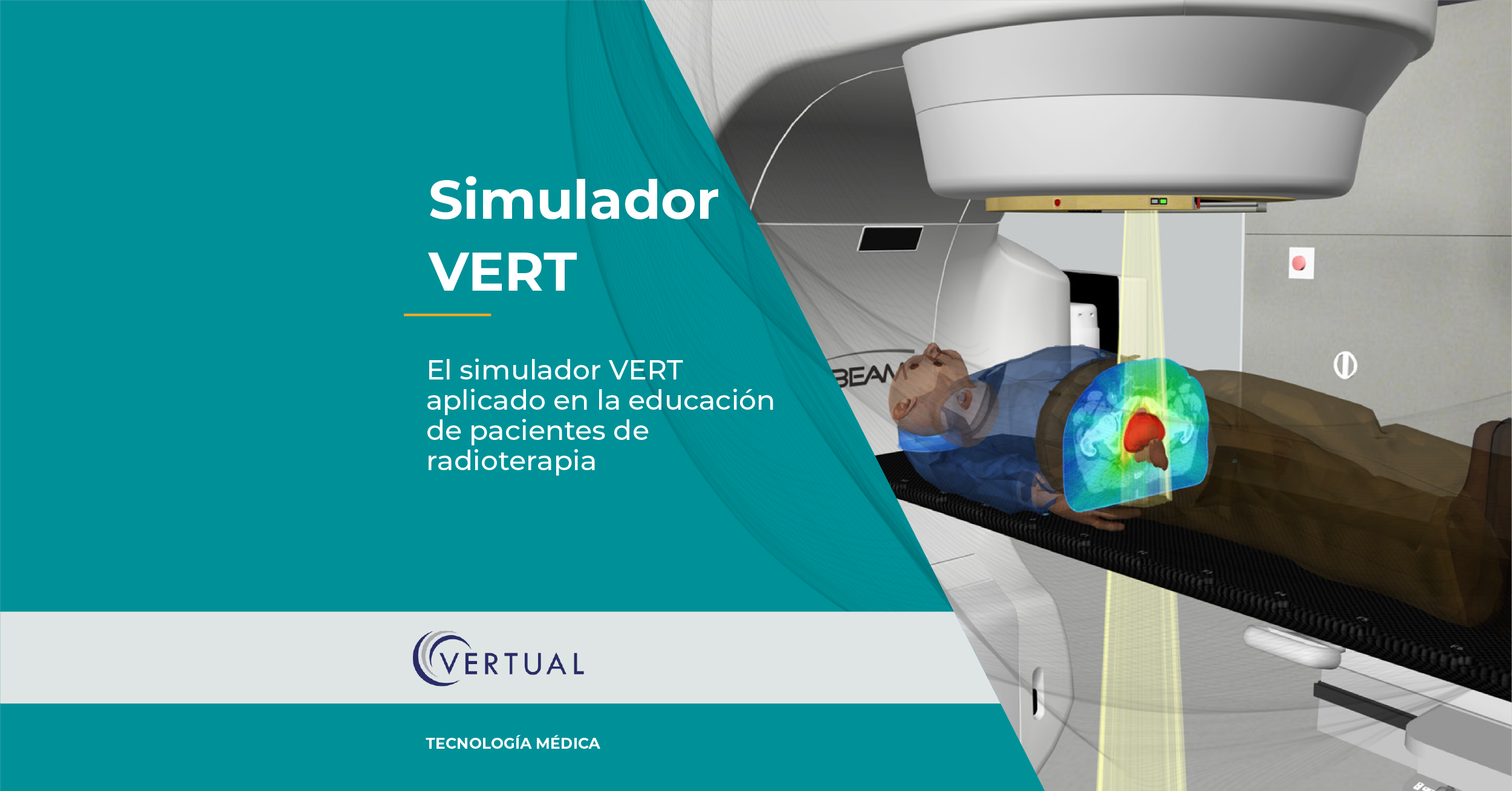 Simulador Vert Para Pacientes De Radioterapia Δ Atfísica