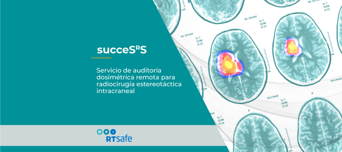 succesrs-servicio-de-rtsafe-de-auditoria-dosimetrica-remota-para-radiocirugia-estereotactica-intracraneal