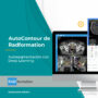 autocontour-deep-learning-para-radioterapia-radformation