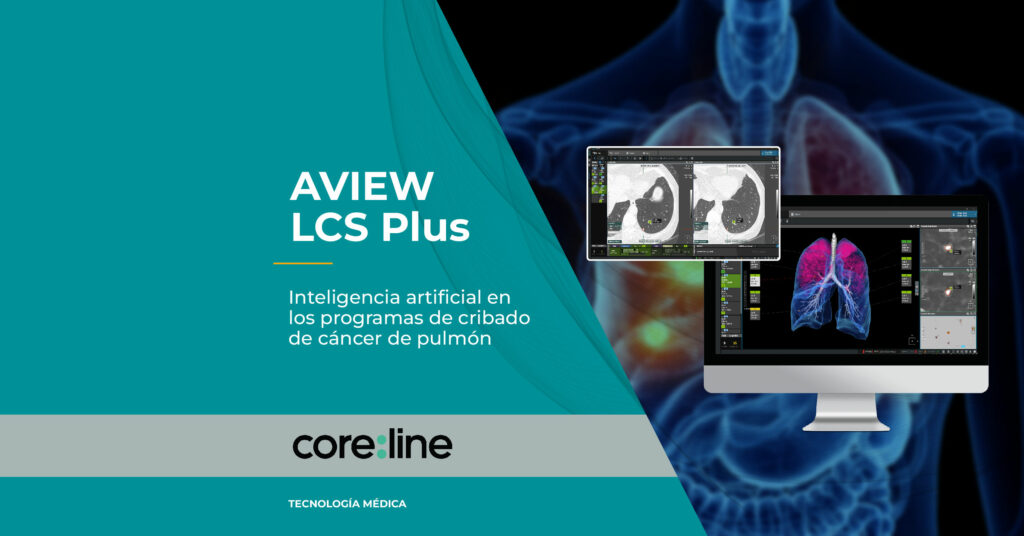 inteligencia-artificial-cancer-pulmon-cribado-aview-lcs-plus-coreline-soft