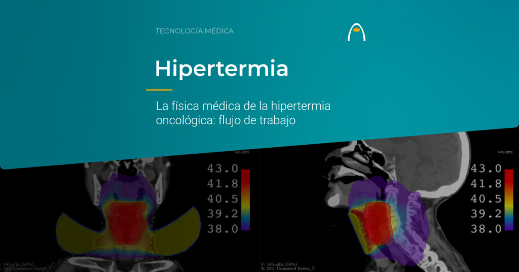 fisica-medica-de-la-hipertermia-oncologica-flujo-de-trabajo-alba-medlogix