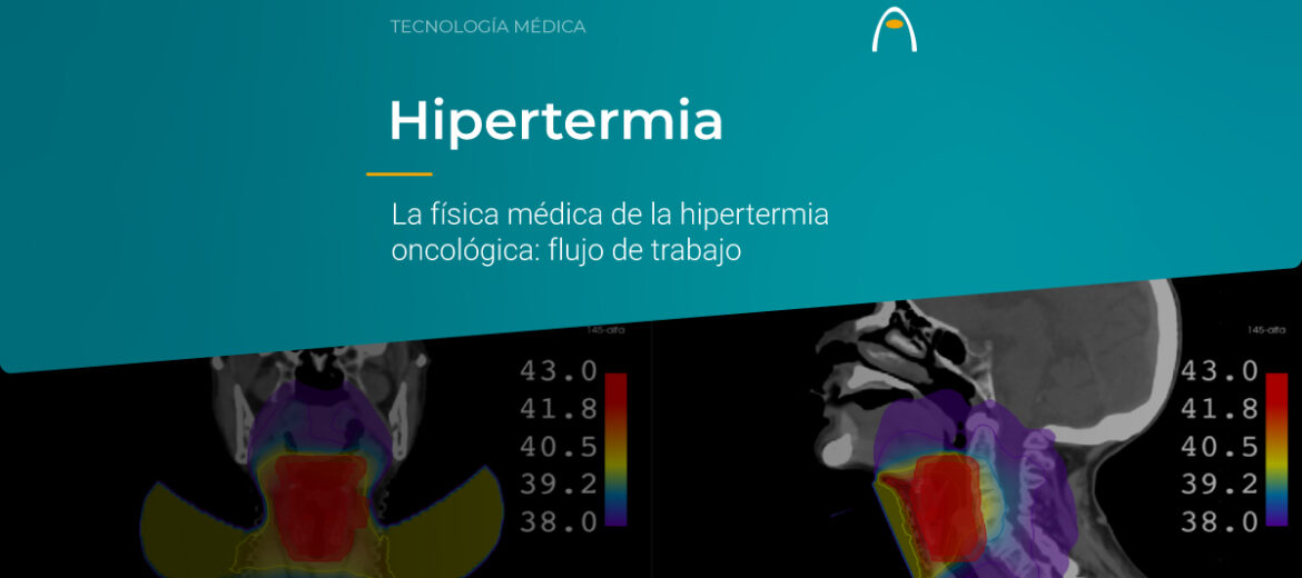 fisica-medica-de-la-hipertermia-oncologica-flujo-de-trabajo-alba-medlogix