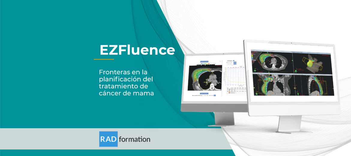 ezfluence radformation planificación del tratamiento de cancer de mama radioterapia
