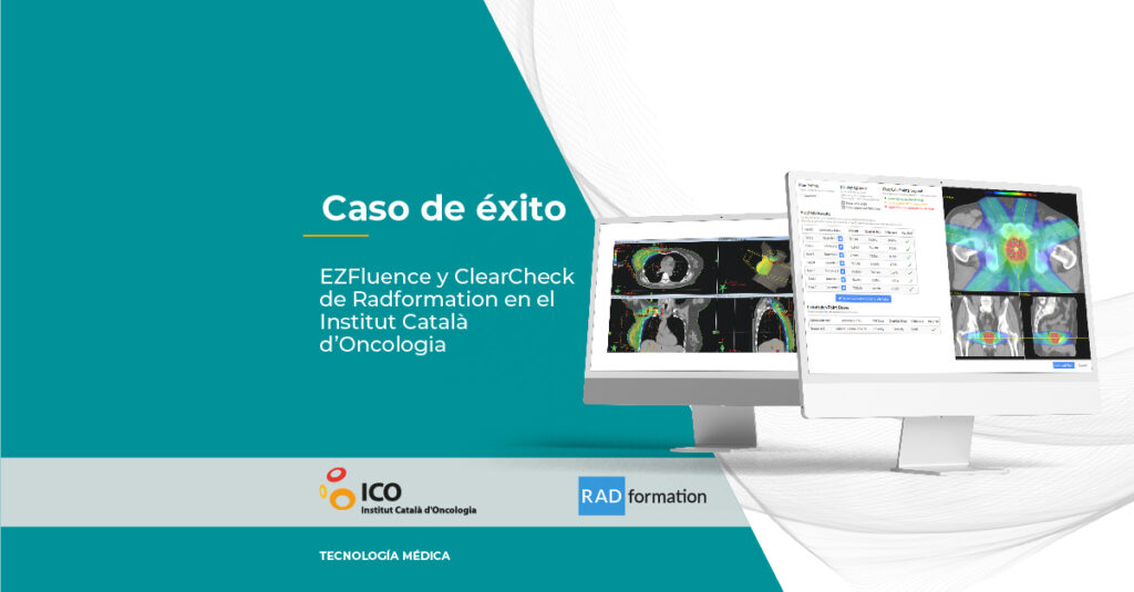 caso-de-exito-ezfluence-y-clearcheck-de-radformation-en-el-institut-catala-doncologia planificación de tratamientos de radioterapia