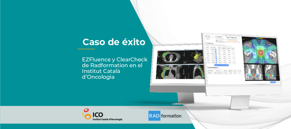 caso-de-exito-ezfluence-y-clearcheck-de-radformation-en-el-institut-catala-doncologia planificación de tratamientos de radioterapia