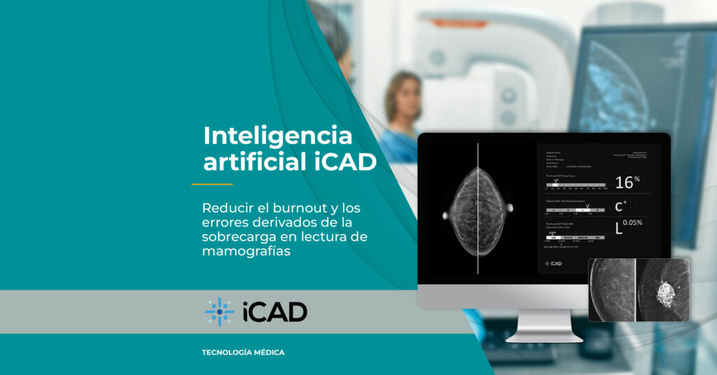 inteligencia-artificial-icad-burnout-errores-sobrecarga-lectura-de-mamografias