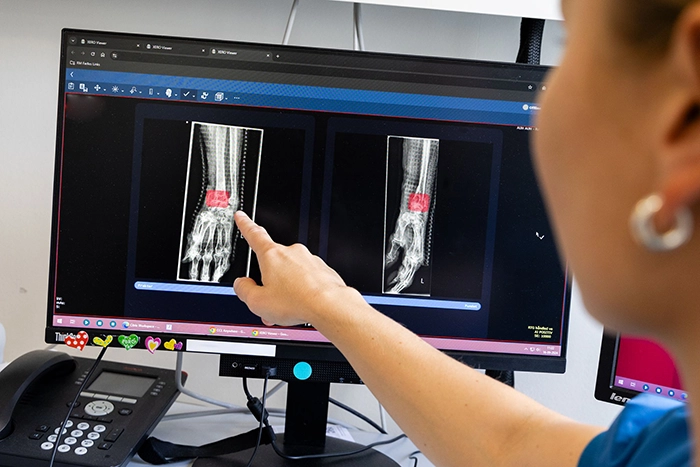 RBfracture-at-Aarhus-University